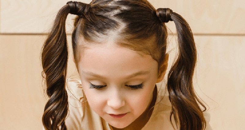 ریزش موی کششی در کودکان