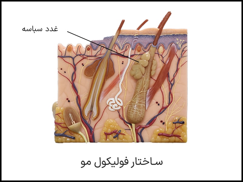 ساختار فولیکول مو و غدد سباسه